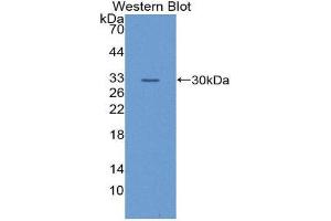 Western Blotting (WB) image for anti-Glutathione S-Transferase theta 1 (GSTT1) (AA 7-231) antibody (ABIN1868285) (GSTT1 Antikörper  (AA 7-231))