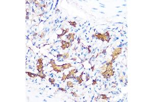 Immunohistochemistry of paraffin-embedded rat lung using FGF21 Rabbit mAb (ABIN1680154, ABIN3018263, ABIN3018264 and ABIN7101589) at dilution of 1:100 (40x lens). (FGF21 Antikörper)