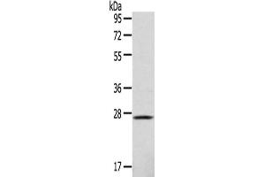 Gel: 10 % SDS-PAGE,Lysate: 40 μg,Primary antibody: ABIN7128967(CLEC4D Antibody) at dilution 1/123 dilution,Secondary antibody: Goat anti rabbit IgG at 1/8000 dilution,Exposure time: 1 minute (CLEC4D Antikörper)