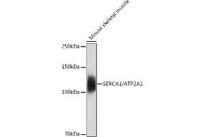 Western blot analysis of extracts of Mouse skeletal muscle, using SERC/ Rabbit mAb (9639) at 1:500 dilution. (ATP2A1/SERCA1 Antikörper)