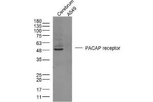 Mouse brain lysates and Human A549 cells probed with PACAP receptor 1 Polyclonal Antibody, unconjugated  at 1:300 overnight at 4°C followed by a conjugated secondary antibody at 1:10000 for 90 minutes at 37°C.