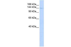WB Suggested Anti-CIITA Antibody Titration:  0. (CIITA Antikörper  (Middle Region))