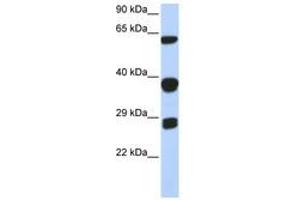 Image no. 1 for anti-Small Nuclear Ribonucleoprotein Polypeptides B and B1 (SNRPB) (AA 72-121) antibody (ABIN6740670) (SNRPB Antikörper  (AA 72-121))