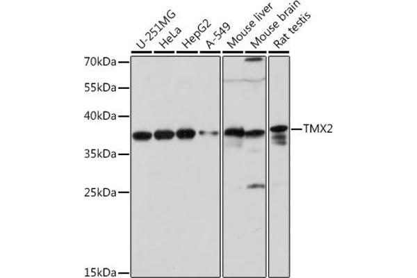 TMX2 Antikörper  (AA 128-296)
