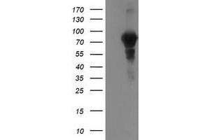 HEK293T cells were transfected with the pCMV6-ENTRY control (Left lane) or pCMV6-ENTRY VCAM1 (Right lane) cDNA for 48 hrs and lysed. (VCAM1 Antikörper)