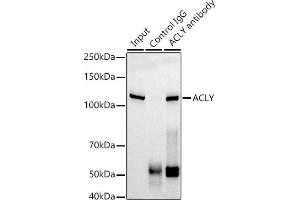 Immunoprecipitation analysis of 300 μg extracts of HepG2 cells using 3 μg ACLY antibody (ABIN1678575, ABIN7101559, ABIN7101560 and ABIN7101561). (ACLY Antikörper)