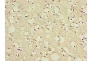 Immunohistochemistry of paraffin-embedded human brain tissue using ABIN7172431 at dilution of 1:100 (TCEAL7 Antikörper  (AA 1-100))