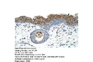 Rabbit Anti-EIF2A Antibody  Paraffin Embedded Tissue: Human Skin Cellular Data: Epidermal cells Antibody Concentration: 4. (EIF2A Antikörper  (C-Term))