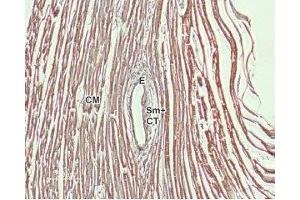 Expression of NCX1 in rat heart - Immunohistochemical staining of rat heart paraffin-embedded sections using Anti-NCX1 (SLC8A1) Antibody (ABIN7043754, ABIN7044875 and ABIN7044876), (1:100). (SLC8A1 Antikörper  (3rd Intracellular Loop))