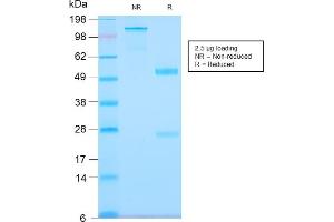 SDS-PAGE Analysis Purified Tenascin C Rabbit Recombinant Monoclonal Antibody (TNC/2981R). (Rekombinanter TNC Antikörper)