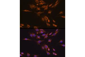 Immunofluorescence analysis of C6 cells using CNTF Rabbit pAb (ABIN3015704, ABIN3015705, ABIN3015706 and ABIN6219054) at dilution of 1:100 (40x lens). (CNTF Antikörper  (AA 1-200))