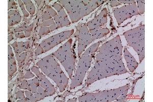 Immunohistochemical analysis of paraffin-embedded rat muscle, antibody was diluted at 1:100. (CDK4 Antikörper  (N-Term))