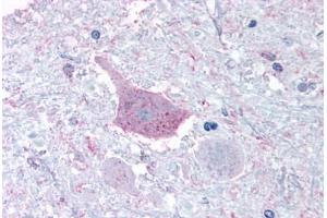 Anti-MRGPRD antibody  ABIN1049069 IHC staining of human brain, medulla. (MRGPRD Antikörper  (Cytoplasmic Domain))