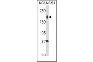 Western blot analysis of CD49b / ITGA2 Antibody (C-term) in MDA-MB231 cell line lysates (35ug/lane). (ITGA2 Antikörper  (C-Term))