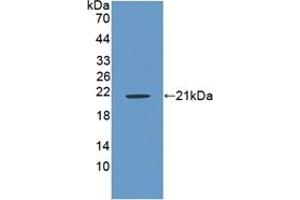 Detection of Recombinant RSPO1, Rat using Polyclonal Antibody to R-Spondin 1 (RSPO1) (RSPO1 Antikörper  (AA 136-262))