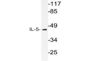Western blot (WB) analysis of IL-5 antibody in extracts from HT-29 cells. (IL-5 Antikörper)