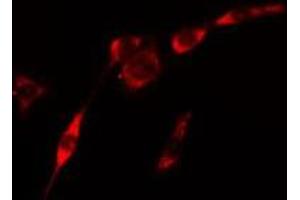 ABIN6275436 staining Hela cells by IF/ICC. (RAB3GAP2 Antikörper  (Internal Region))
