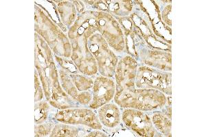 Immunohistochemistry of paraffin-embedded rat ovary using DNA Ligase III/LIG3 Rabbit pAb (ABIN6130288, ABIN6143207, ABIN6143208 and ABIN6217532) at dilution of 1:50 (40x lens). (LIG3 Antikörper  (AA 730-1009))