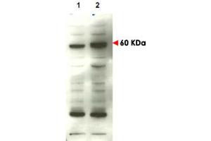 Western blot using SMAD4 polyclonal antibody  to detect over-expressed SMAD4 in transfected COS cells (lane 2). (SMAD4 Antikörper  (C-Term))