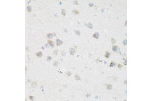 Immunohistochemistry of paraffin-embedded mouse brain using NFU1 antibody at dilution of 1:200 (40x lens). (NFU1 Antikörper)
