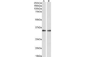 ABIN570988 (0. (PPP4C Antikörper  (C-Term))