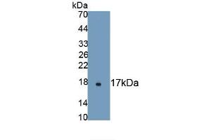 Detection of Recombinant aHSP, Human using Monoclonal Antibody to Alpha-Hemoglobin Stabilizing Protein (aHSP) (aHSP Antikörper  (AA 1-102))