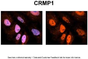 Sample Type: NT2 cells Red: Antibody Blue: DAPI Primary Dilution: 1ug/50ul antibody Secondary Antibody: Alexa goat anti-rabbit 594 Image Submitted by: Yuzhi Chen, University of Arkansas for Medical Sciences (CRMP1 Antikörper  (N-Term))