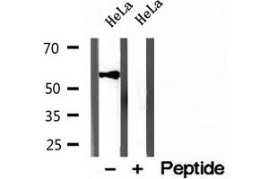 Western blot analysis of extracts of HeLa cells, using KMO antibody. (KMO Antikörper  (Internal Region))