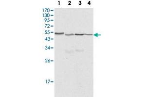 Western blot analysis of CALR monoclonal antibody, clone 1G6A7  against HeLa (1), A-549 (2), NTERA2 (3) and MCF-7 (4) cell lysate. (Calreticulin Antikörper)