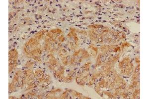 Immunohistochemistry of paraffin-embedded human adrenal gland tissue using ABIN7143672 at dilution of 1:100 (ALDH3B2 Antikörper  (AA 57-311))