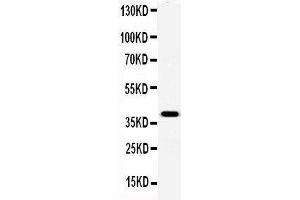 Anti-Serum Amyloid P Picoband antibody,  All lanes: Anti-Serum Amyloid P at 0. (APCS Antikörper  (AA 21-224))