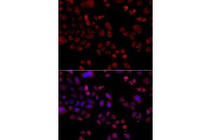 Immunofluorescence analysis of A549 cells using SLC22A11 antibody (ABIN5975730). (SLC22A11 Antikörper)