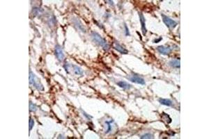 Immunohistochemistry (IHC) image for anti-ISG15 Ubiquitin-Like Modifier (ISG15) (AA 31-61) antibody (ABIN3031502)