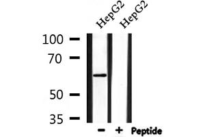 Western blot analysis of extracts from HepG2, using AATF Antibody. (AATF Antikörper  (N-Term))