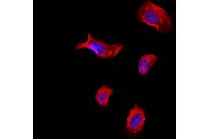 ABIN6265428 and ABIN6266799 staining Hela by IF/ICC. (TACC1 Antikörper  (N-Term))