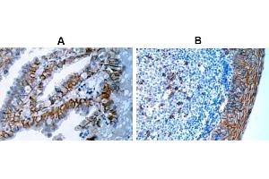 Immunohistochemistry (IHC) image for anti-Syndecan 1 (SDC1) antibody (ABIN487501) (Syndecan 1 Antikörper)