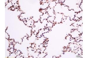 Paraformaldehyde-fixed, paraffin embedded rat lung, Antigen retrieval by boiling in sodium citrate buffer (pH6) for 15min, Block endogenous peroxidase by 3% hydrogen peroxide for 30 minutes, Blocking buffer (normal goat serum) at 37°C for 20min, Antibody incubation with Rabbit Anti-PLC gamma 1 (Tyr783) Polyclonal Antibody, Unconjugated  at 1:200 overnight at 4°C, followed by a conjugated secondary for 90 minutes and DAB staining (Phospholipase C gamma 1 Antikörper  (pTyr783))