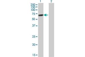 Western Blot analysis of DDX56 expression in transfected 293T cell line by DDX56 MaxPab polyclonal antibody. (DDX56 Antikörper  (AA 1-547))