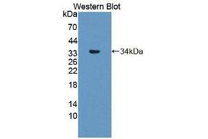 Western blot analysis of the recombinant protein. (Phospholipase C delta 3 Antikörper  (AA 528-789))