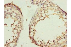Immunohistochemistry of paraffin-embedded human testis tissue using ABIN7157234 at dilution of 1:100 (KANSL3 Antikörper  (AA 1-200))