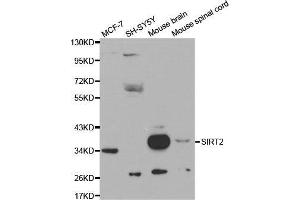 Western blot analysis of extracts of various cell lines, using SIRT2 antibody. (SIRT2 Antikörper  (AA 288-389))