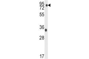 Western blot analysis of TBK1 antibody and K562 lysate. (TBK1 Antikörper  (AA 150-181))