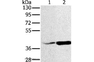 Western blot analysis of Hela and A549 cell, using NDUFA10 Polyclonal Antibody at dilution of 1:500 (NDUFA10 Antikörper)