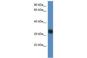 WB Suggested Anti-Gm527 Antibody Titration: 1. (GM527 Antikörper  (C-Term))