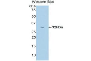 Western Blotting (WB) image for anti-Uromodulin (UMOD) (AA 334-589) antibody (ABIN1176571) (Uromodulin Antikörper  (AA 334-589))