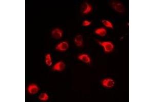 Immunofluorescent analysis of Carbonic Anhydrase 3 staining in Hela cells. (CA3 Antikörper)