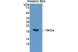 Detection of Recombinant PDIA5, Human using Polyclonal Antibody to Protein Disulfide Isomerase A5 (PDIA5) (PDIA5 Antikörper  (AA 378-506))