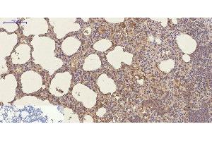 Immunohistochemistry of paraffin-embedded Mouse lung tissue using CD23 Monoclonal Antibody at dilution of 1:200. (FCER2 Antikörper)