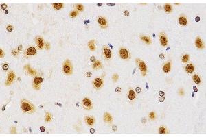 Immunohistochemistry (Paraffin-embedded Sections) (IHC (p)) image for anti-Histone H4 (H4R3me2a) antibody (ABIN7260410)