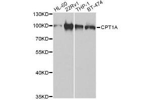Western blot analysis of extracts of various cell lines, using CPT1A Antibody. (CPT1A Antikörper  (AA 497-756))